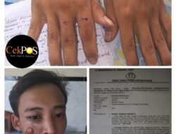 Jadi Korban Penganiayaan Hingga Lebam, Seorang Kernet Lapor Polisi