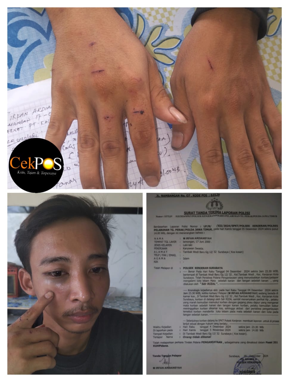 Foto : Korban Penganiayaan di Tambak Wedi Baru