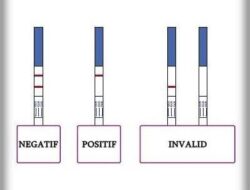 Ngeriii!!! Hasil Tes Urine Negatif, Tetap Direhabilitasi