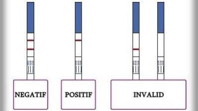 Ngeriii!!! Hasil Tes Urine Negatif, Tetap Direhabilitasi